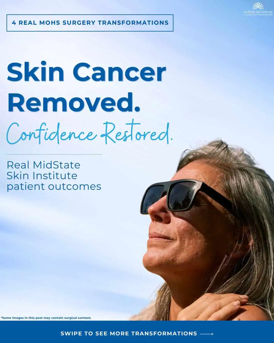 Skin cancer can feel overwhelming, especially when it affects visible areas like the face. Mohs _1